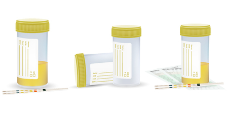 Urine sample set, full and empty containers. Vector illustration, eps 10のイラスト素材
