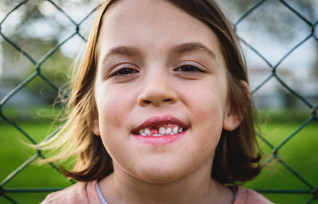 Portrait of toothless child girl missing milk and permanent teeth. Closeup of young kid with teeth gaps and growing permanent teeth and healthy gums posing outdoors in nature.の写真素材