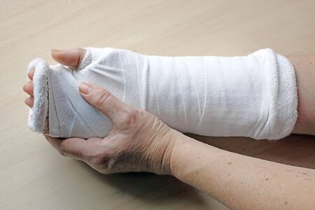 A woman has a splint and bandage on an injured handの写真素材