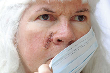 Masks required for injuries and operations