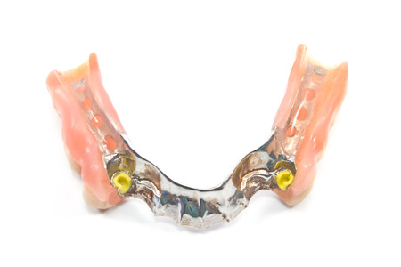 Partial denture bottom side - dental prosthetics isolated on white 