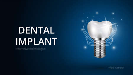 Realistic white dental implant on a blue background with text. Vector 3d model of a tooth with carvingのイラスト素材