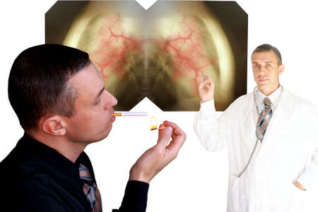 health service notify-smoking  harmful habit  is not healthy for youの写真素材