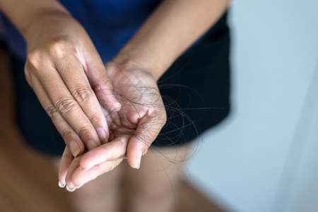 Hair loss on hand problem for health care conceptの写真素材