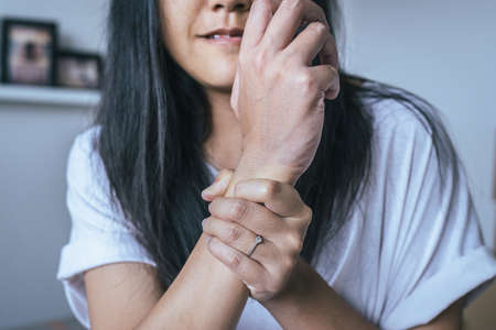 Blood vessel or Varicose veins on hand womans,Concept Health and Skinの写真素材