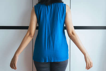 Woman with dry skin on elbow and arm,Body and health care conceptの写真素材