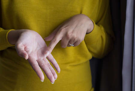 Woman with hand removes flaky skin,Health care skin concept,Close up