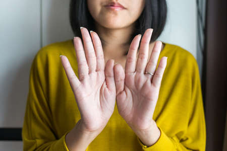 Asian female with hand removes flaky skin,Health care skin concept,Close upの写真素材