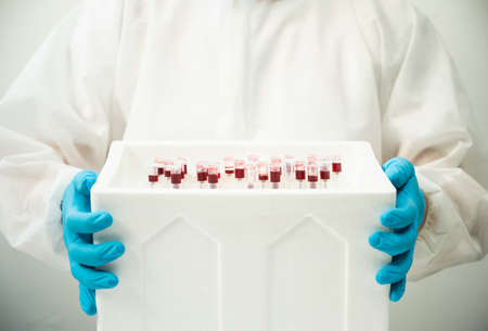 The doctor was holding a blood vessel that was tested for Covid 19. Blood test samples of...