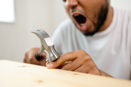 The carpenter was injured by hammer and nails. He misused the hammer and stuck it in his hand. Accidents during work require accident insurance.の写真素材