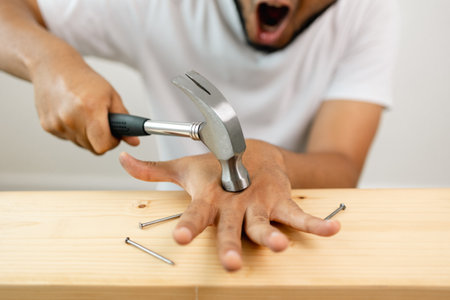The carpenter was injured by hammer and nails. He misused the hammer and stuck it in his hand. Accidents during work require accident insurance.の写真素材