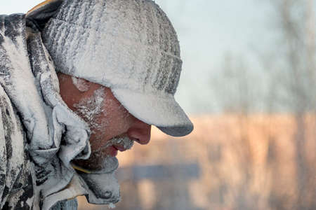 Close-up of a man with hoarfrost face