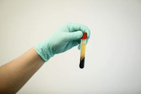 Details with the hand of a doctor, wearing rubber surgical glove and holding a vial of blood plasma extracted from blood by centrifugationの写真素材