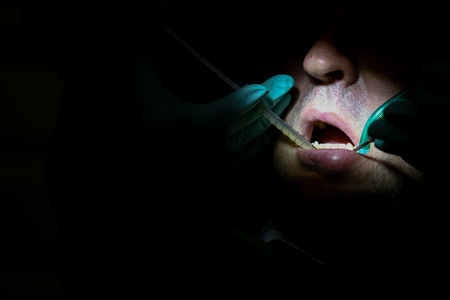 Details with the hands of a woman dentist, with surgical gloves, injecting blood plasma in the gums...