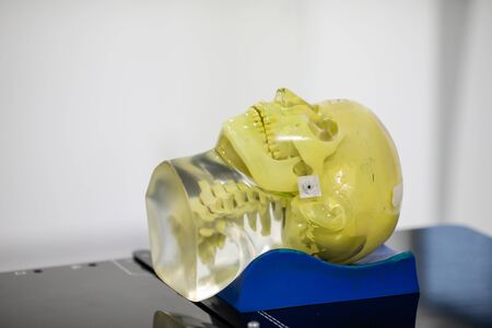 Human tissue mimicking mannequin head on a medical linear accelerator (LINAC) used for radiation...