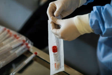Bucharest, Romania - March 13, 2020: Details with the hands of a medic using a coronavirus test on a...