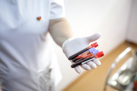 Shallow depth of field (selective focus) details with a female medical worker holding blood vials after a blood donation.の写真素材