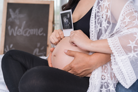 Pregnant woman with her husband holding ultrasound scanの写真素材