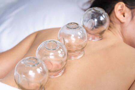 young woman receiving cupping treatment on back