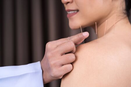 young woman undergoing acupuncture treatment on shoulder