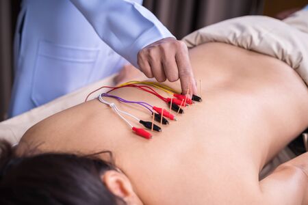 young woman undergoing acupuncture treatment with electrical stimulator on backの写真素材