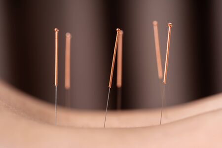 close up woman undergoing acupuncture treatment on backの写真素材