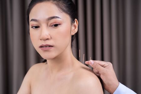 young woman undergoing acupuncture treatment on shoulder