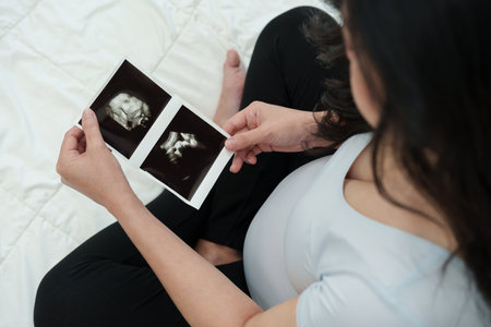 happy pregnant woman looking ultrasound photo of baby on a bed
