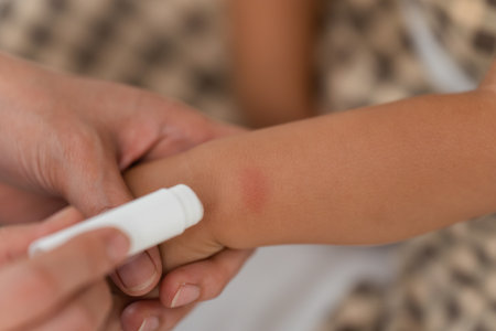 mother applying antiallergic cream on allergy with red spot at baby arm after red bite of mosquitoの写真素材