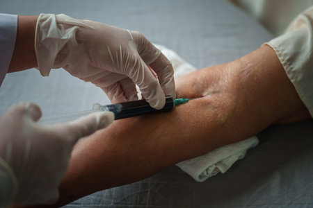 close up of doctor or nurse taking a blood sample from arm vein with a vacutainer. syringe to venipuncture the patientの写真素材