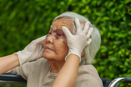 Doctor checking senior woman's face and eye with bruiseの写真素材