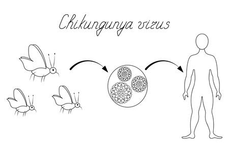 Chikungunya virus infection diagram. Sketch. Italic text. Mosquito-virus-human. Vector illustration. Outline on isolated white background. Doodle style. Coloring book for children.のイラスト素材