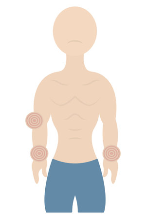 A patient with joint pain. The joints in his hands and elbows are sore. Color vector illustration. Muscular physique. Isolated on white background. Flat style. Medical theme.のイラスト素材