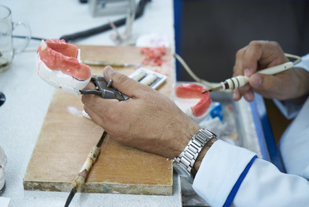 Dental technician using a knife with ceramic dental implants in his laboratory.  Dentist working...