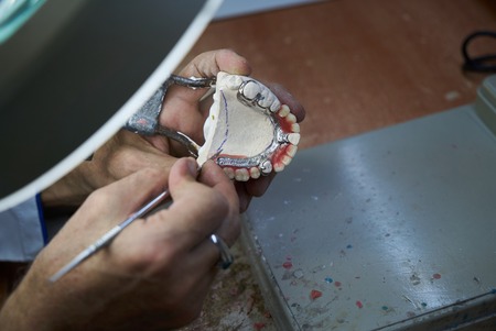Dental technician working with articulator in dental laboratory, close-up. Dentist hands holds...