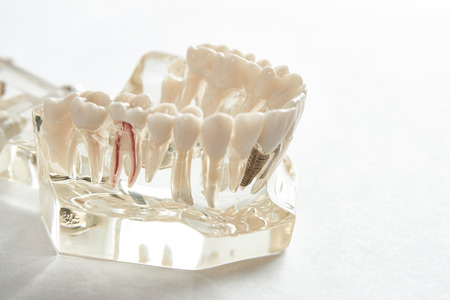 Dental jaw model against white background with copy space. Dentist dental prosthetic teeth, gums, roots close-up. Studying dental diseases conceptの写真素材