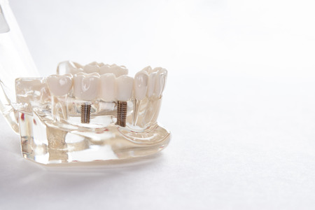 Artificial teeth on a white background with copy space. Dentist appointment, dentistry instruments and dental hygienist checkup concept with teeth model denturesの写真素材