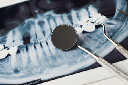 Dental x-ray and dentist tool, close-up. Dental background with copy spaceの写真素材