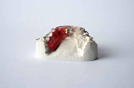 Dental Plate for Children, Retainer for teeth correction. Dental orthodontic bite treatment. Tooth platesの写真素材
