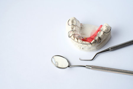 Dental braces, orthodontic bite treatment. Dental Plate for Children, Retainer for teeth correction. Tooth platesの写真素材