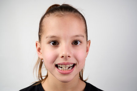 Little girl with teeth retainers looking at camera, close-up. Child with orthodontic plate or dental braces in her mouth. Children's dentistryの写真素材