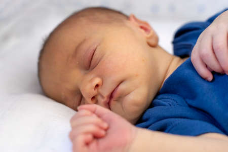 Jaundice in the newborn. Baby with neonatal hyperbilirubinemia.の写真素材