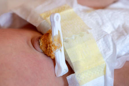 Newborn umbilical cord with clamp, baby belly buttonの写真素材
