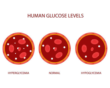 Flat illustrations of human glucose levelsのイラスト素材