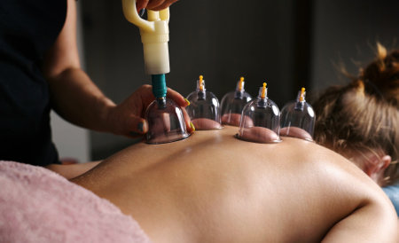 Procedures With The Vacuum Cups In A Massage Spa Salonの写真素材