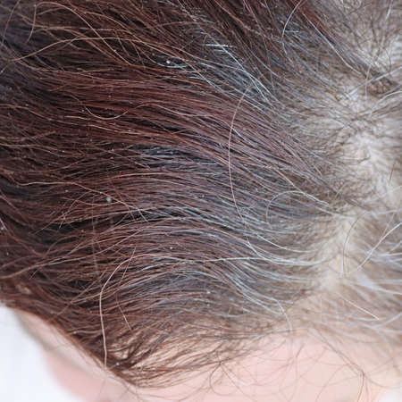 Part of a woman's head. Woman's head and partially gray hairの写真素材