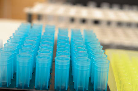 The tubes biochemical laboratory of blue and yellow and transparent glass.