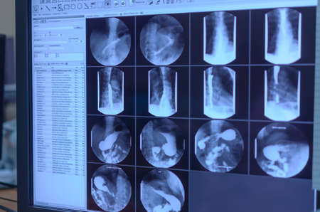 X-ray images as a result of patient diagnosis.