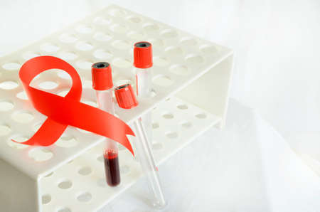 Blood sampling and analysis in a biochemical laboratory on a light background.の写真素材