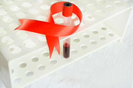 Blood sampling and analysis in a biochemical laboratory on a light background.